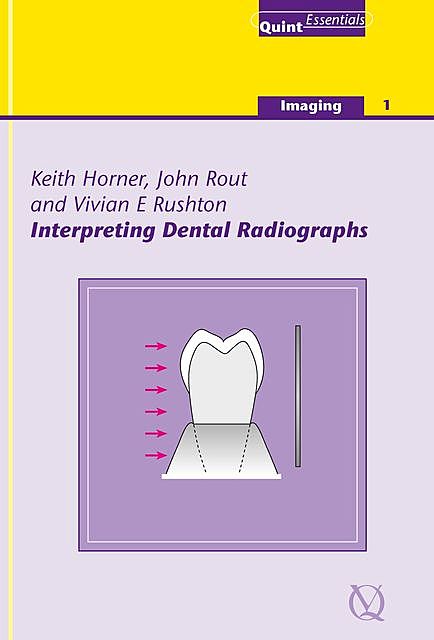 Interpreting Dental Radiographs, John Rout, Vivian E. Rushton, Keith Horner