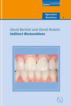 Indirect Restorations, David Bartlett, David Ricketts