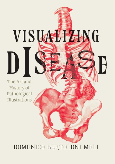 Visualizing Disease, Domenico Bertoloni Meli