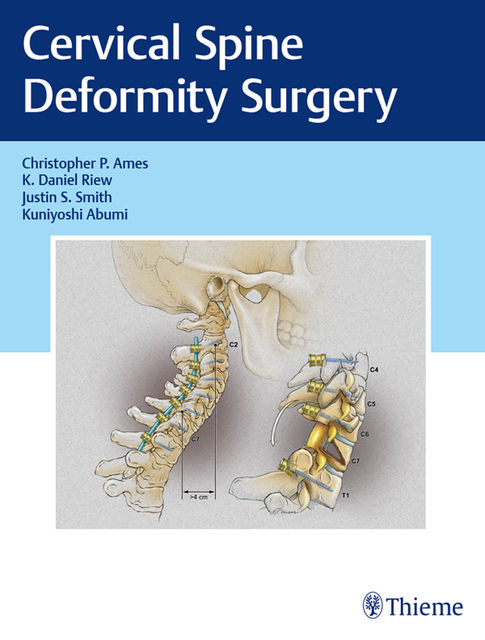 Cervical Spine Deformity Surgery, Justin Smith, Christopher P. Ames, K. Daniel Riew