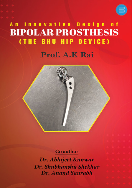 An innovative design of bipolar prosthesis, Anil Kumar Rai