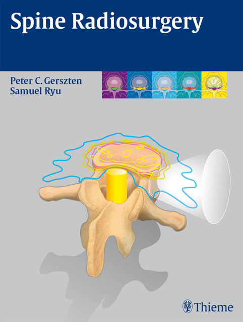 Spine Radiosurgery, Peter C.Gerszten, Samuel Ryu