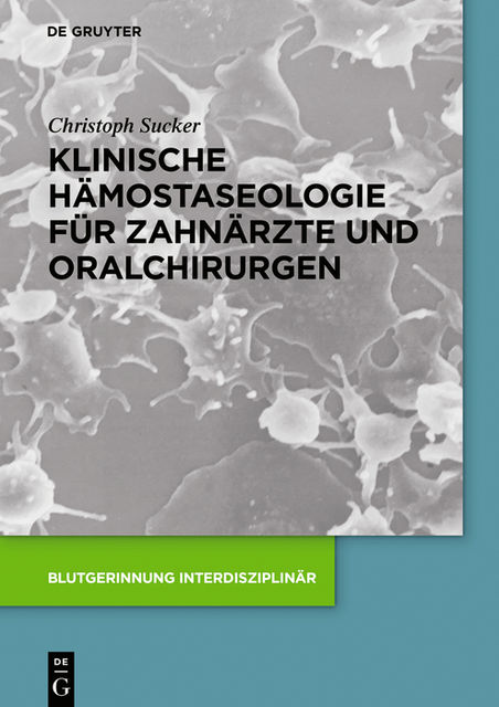 Klinische Hämostaseologie für Zahnärzte und Oralchirurgen, Christoph Sucker