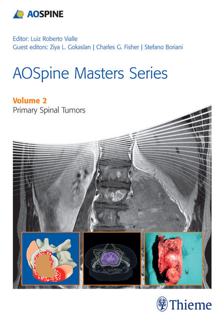 AOSpine Masters Series Volume 2: Primary Spinal Tumors, Ziya L.Gokaslan, Luiz Roberto Gomes Vialle, Stefano Boriani