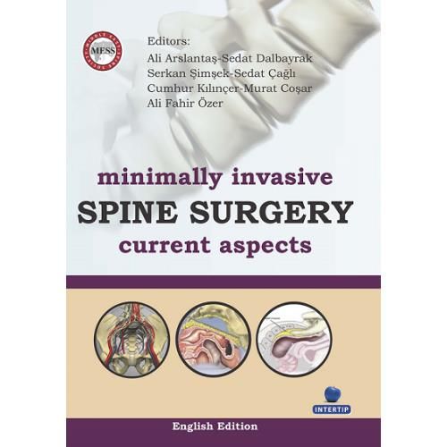 Minimally Invasive Spine Surgery Current Aspects, A. Fahir Özer, Ali Arslantaş, Cumhur Kılınçer, Murat Coşar, Sedat Dalbayrak, Sedat Çağlı, Serkan Şimşek