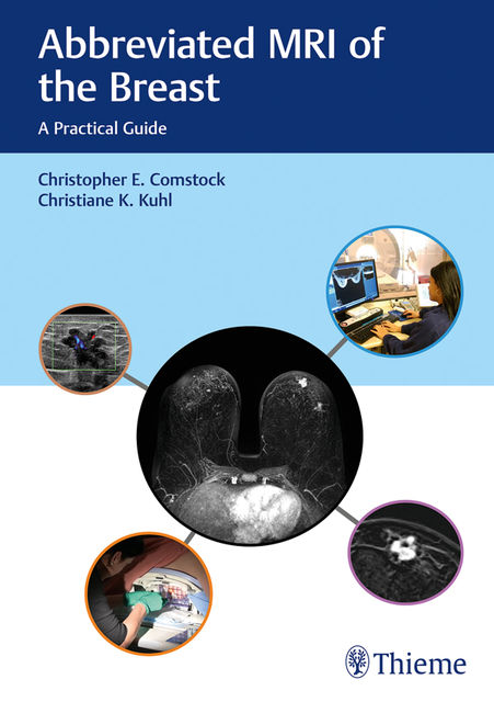 Abbreviated MRI of the Breast, Christiane K. Kuhl, Christopher E. Comstock
