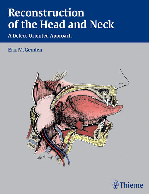 Reconstruction of the Head and Neck, Eric M.Genden