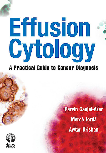 Effusion Cytology, Awtar Krishan, Merce Jorda, Parvin Ganjei-Azar