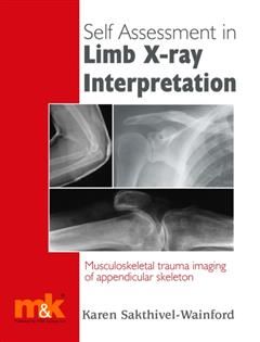 Self-assessment in Limb X-ray Interpretation, Karen Sakthivel-Wainford