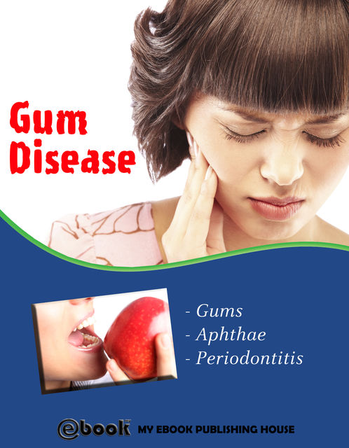 Gum Disease, My Ebook Publishing House