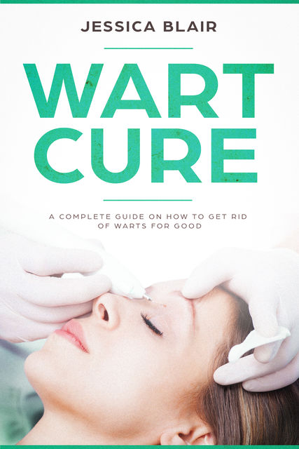 Wart Cure, Jessica Blair