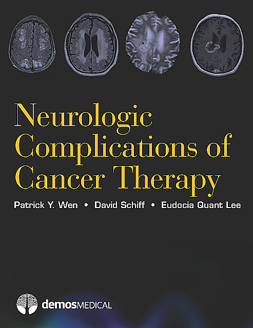 Neurologic Complications of Cancer Therapy, David Schiff, MPH, Eudocia Quant Lee, Patrick Y. Wen