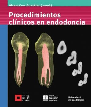Procedimientos clínicos en endodoncia, Martín Rodriguez, Ana Rosa Barragán Tejeda, Carlos E. Bracamontes Campoy, Francisco Yáñez López, Hugo Isaac Contreras Plascencia, Leobardo Santiago Ruvalcaba Muñoz, María Guadalupe Sánchez Antillón, Octavio Amezcua Gutiérrez, Álvaro Cruz González