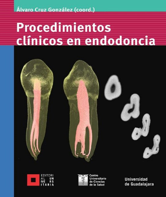 Procedimientos clínicos en endodoncia, Martín Rodriguez, Ana Rosa Barragán Tejeda, Carlos E. Bracamontes Campoy, Francisco Yáñez López, Hugo Isaac Contreras Plascencia, Leobardo Santiago Ruvalcaba Muñoz, María Guadalupe Sánchez Antillón, Octavio Amezcua Gutiérrez, Álvaro Cruz González