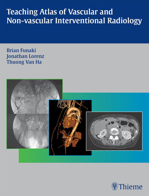 Teaching Atlas of Vascular and Non-vascular Interventional Radiology, Brian Funaki, Thuong G.Van Ha, Jonathan Lorenz