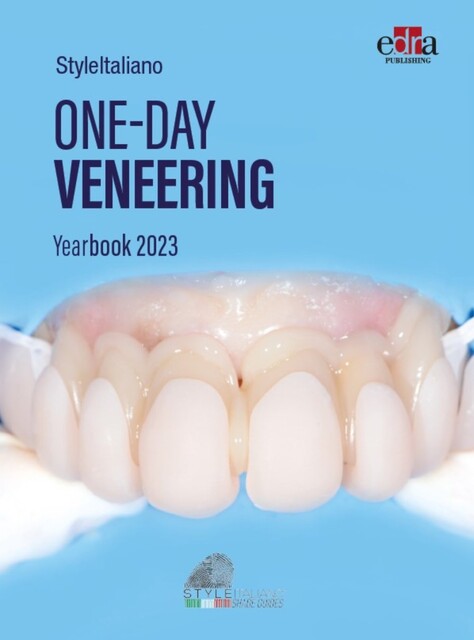 One-day Veneering, Styleitaliano