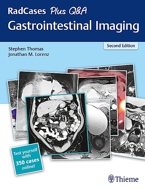 RadCases Plus Q&A Gastrointestinal Imaging, Stephen Thomas, Jonathan Lorenz