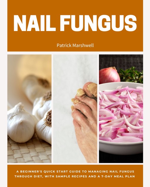 Nail Fungus, Patrick Marshwell