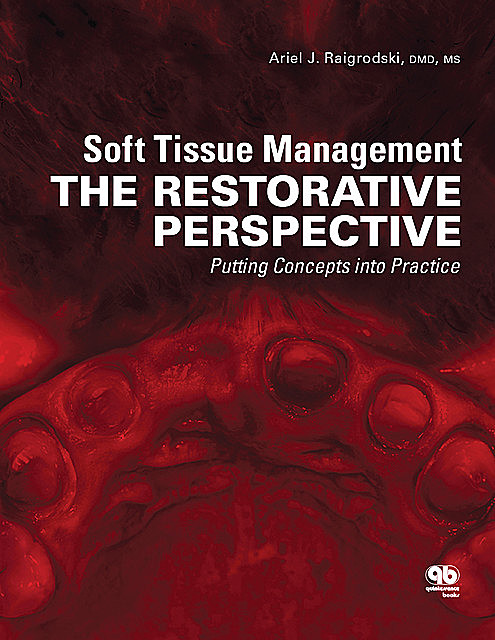 Soft Tissue Management, Ariel J. Raigrodski