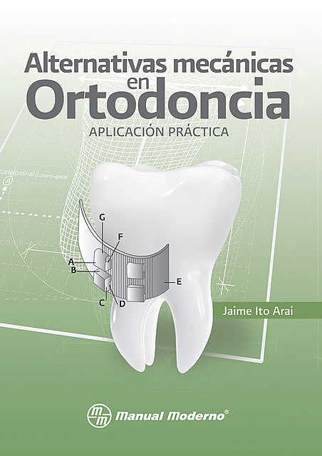 Alternativas mecánicas en Ortodoncia. Aplicación práctica, Jaime Ito Arai