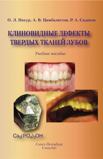 Клиновидные дефекты твердых тканей зубов, Александр Цимбалистов, Оксана Пихур, Роман Садиков
