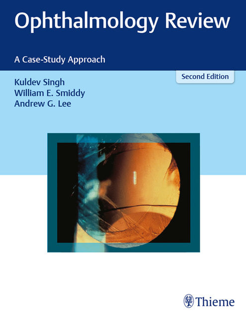 Ophthalmology Review, Andrew Lee, Kuldev Singh, William E.Smiddy