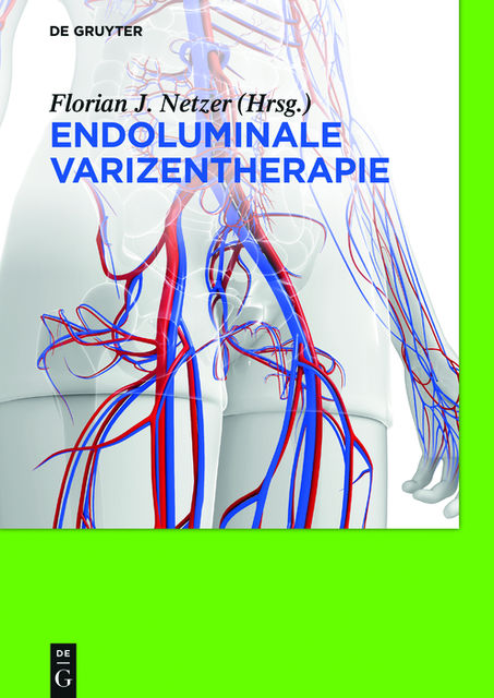 Endoluminale Varizentherapie, Florian Johannes Netzer