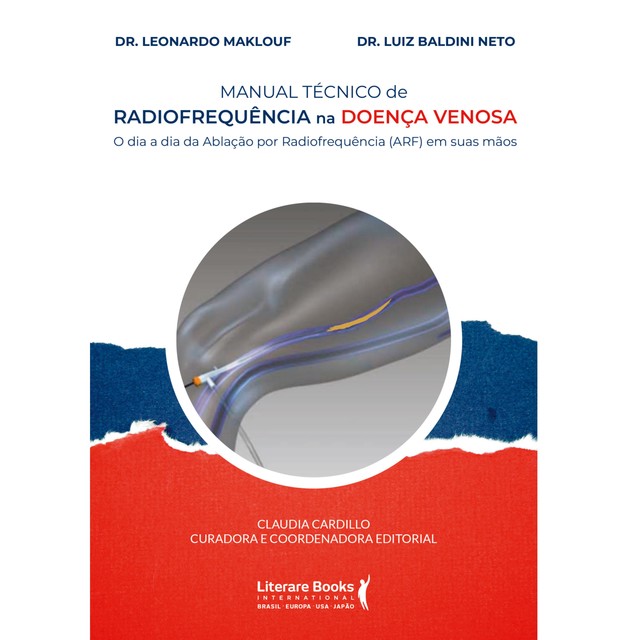 Manual técnico de radiofrequência na doença venosa, Claudia Cardillo, Leonardo Chadad Maklouf, Luiz Baldini Neto