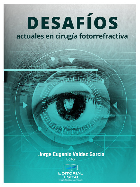 Desafíos actuales en cirugía fotorrefractiva, Jorge Eugenio Valdez García