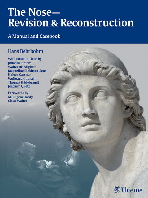 The Nose - Revision and Reconstruction, Hans Behrbohm, Jacqueline Eichhorn-Sens, Joachim Ulrich Quetz
