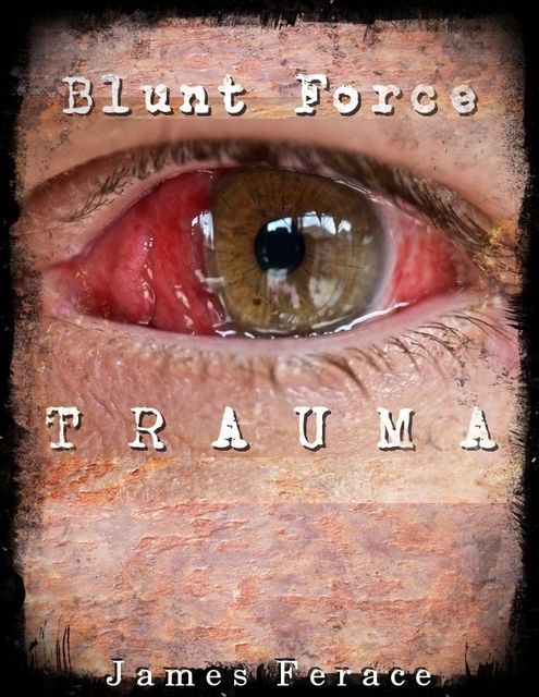 Blunt Force Trauma, James Ferace