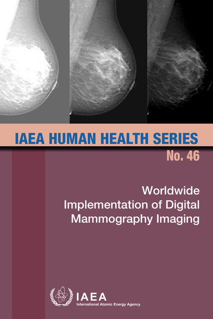 Worldwide Implementation of Digital Mammography Imaging, IAEA