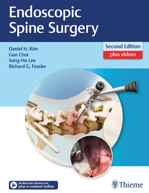 Endoscopic Spine Surgery, Daniel H.Kim, Richard G.Fessler, Gun Choi, Sang-Ho Lee