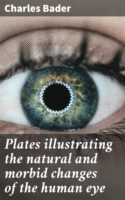 Plates illustrating the natural and morbid changes of the human eye, Charles Bader