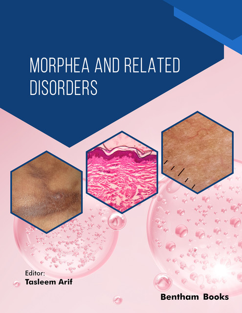 Morphea and Related Disorders, Tasleem Arif