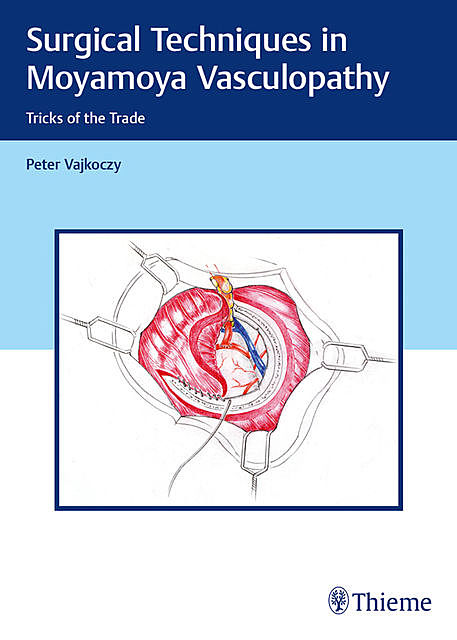 Surgical Techniques in Moyamoya Vasculopathy, Peter Vajkoczy