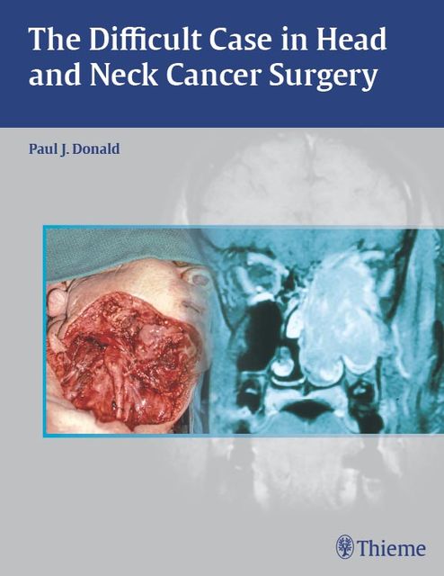 Difficult Case in Head and Neck Cancer Surgery, Paul J.Donald
