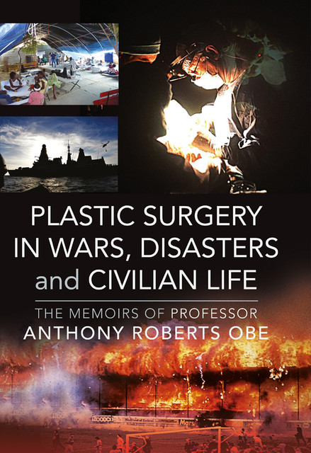 Plastic Surgery in Wars, Disasters and Civilian Life, Anthony Roberts