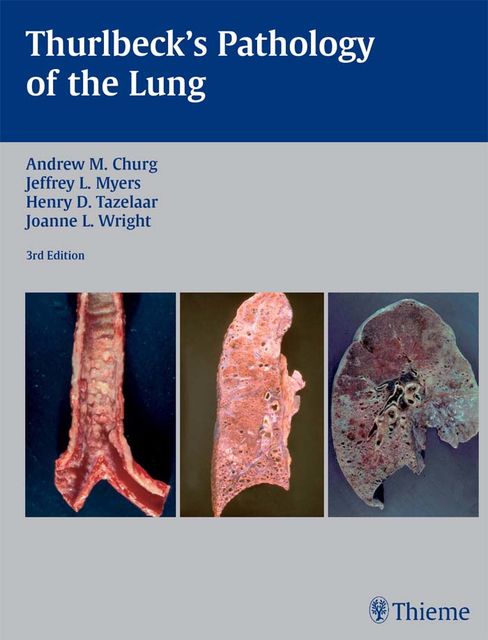 Thurlbeck's Pathology of the Lung, Andrew M.Churg, Henry D.Tazelaar, Jeffrey L.Myers