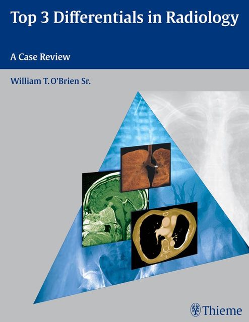 Top 3 Differentials in Radiology, William O'Brien