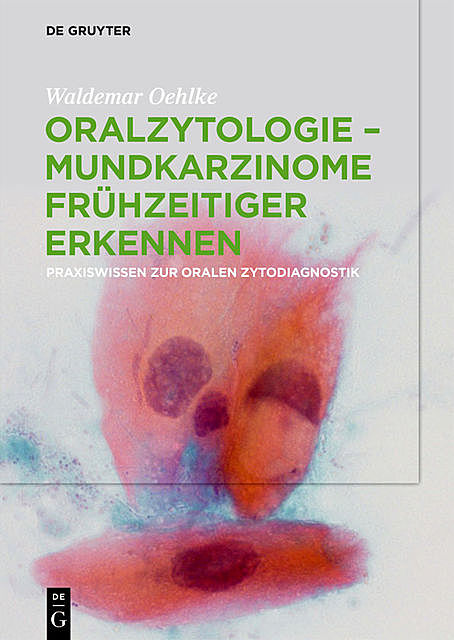 Oralzytologie – Mundkarzinome frühzeitiger erkennen, Waldemar Oehlke