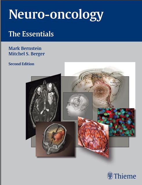 Neuro-oncology: The Essentials, Mark Bernstein, Mitchel S.Berger