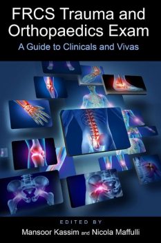 FRCS Trauma and Orthopaedics Exam: A guide to clinicals and vivas, Mansoor Kassim