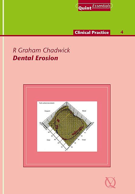 Dental Erosion, R. Graham Chadwick