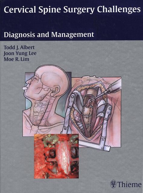 Cervical Spine Surgery Challenges, Todd J.Albert, Joon Yung Lee, Moe R.Lim