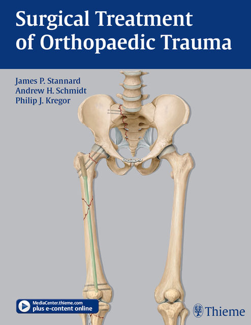 Surgical Treatment of Orthopaedic Trauma, Andrew H.Schmidt, James P.Stannard, Philip J.Kregor