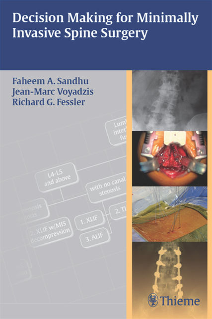 Decision Making for Minimally Invasive Spine Surgery, Richard G.Fessler, Faheem A.Sandhu, Jean-Marc Voyadzis