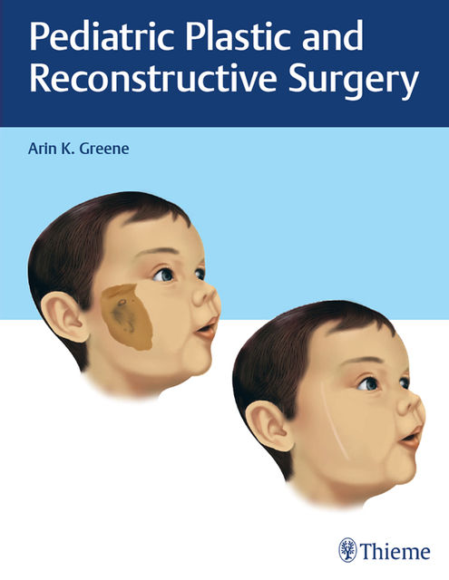 Pediatric Plastic and Reconstructive Surgery, Arin K. Greene
