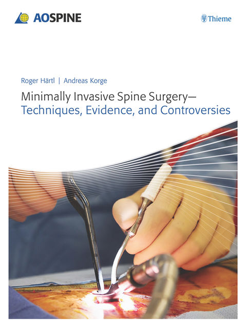Minimally Invasive Spine Surgery, Andreas Korge, Roger Haertl