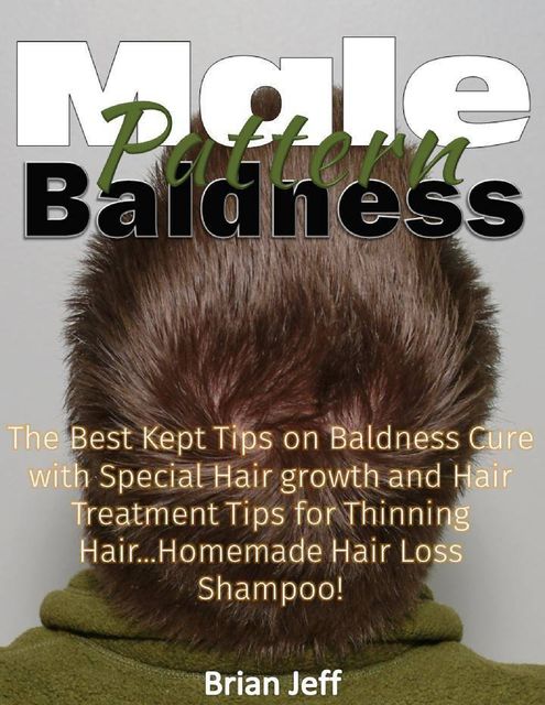 Male Pattern Baldness: The Best Kept Tips On Baldness Cure With Special Hair Growth and Hair Treatment Tips for Thinning Hair Homemade Hair Loss Shampoo, Brian Jeff